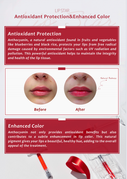 Lip Star Filler